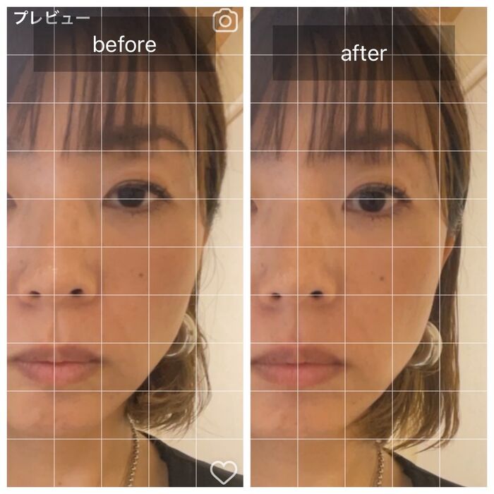 サロンの内観写真や施術の実例を展示